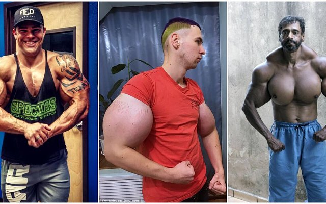 Hazard se zdravím: Synthol může způsobit amputaci končetin či smrt