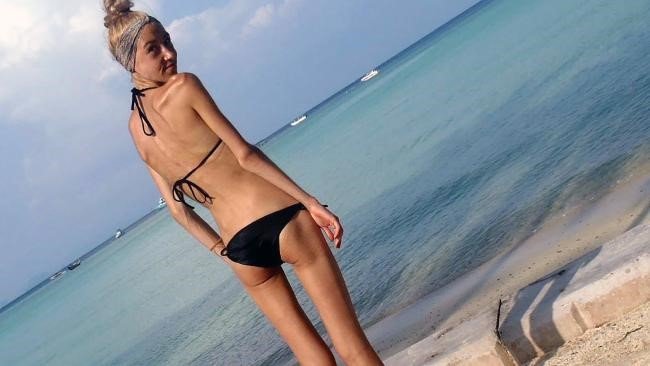 Porazila anorexiu a vyformovala si krásnu postavu